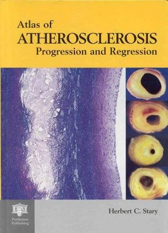 An Atlas of Atherosclerosis: Progression and Regression by Herbert C. Stary